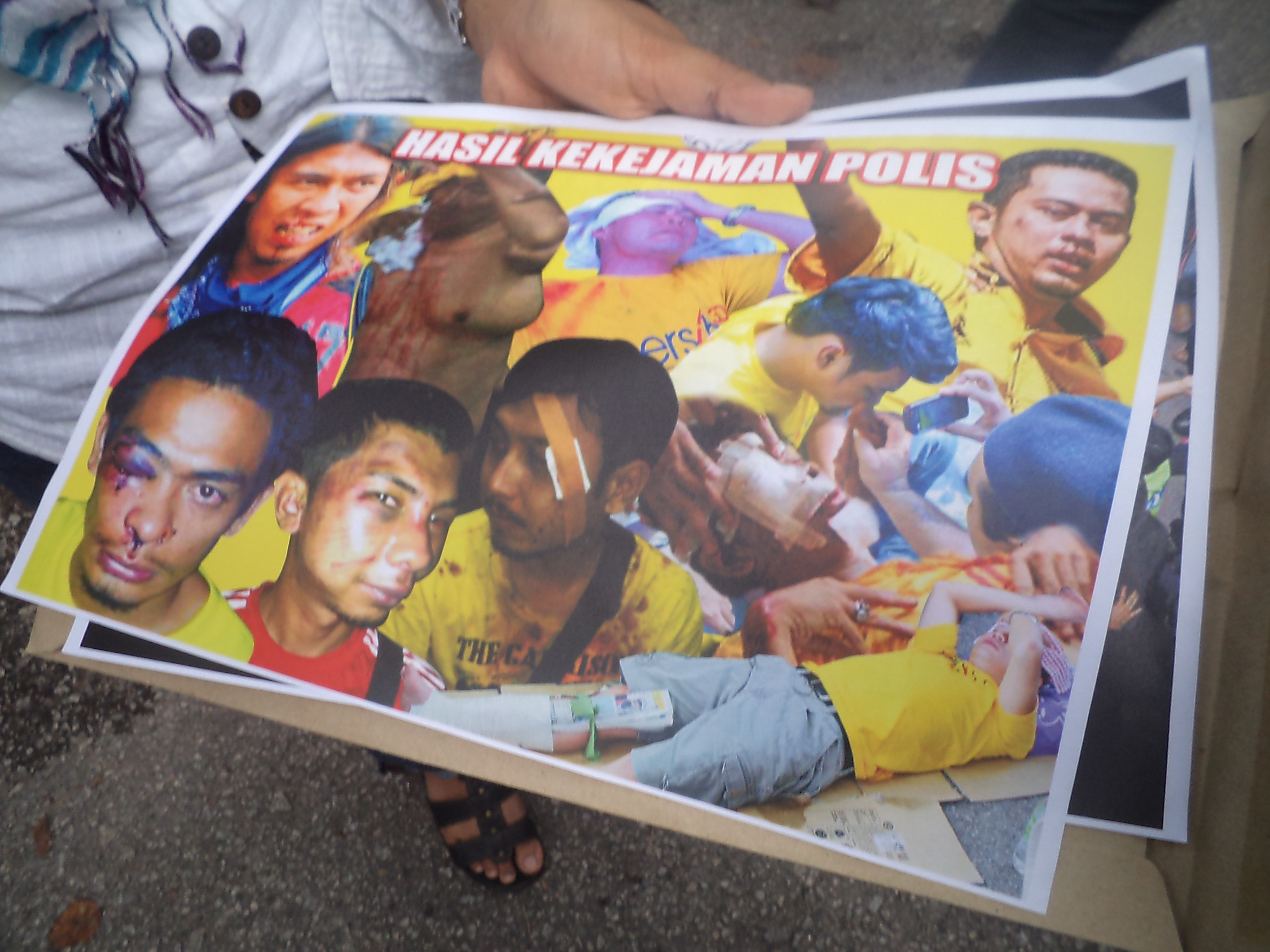 Para mangsa keganasan pihak polis.