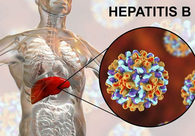 Hepatitis Day highlights the silent killer